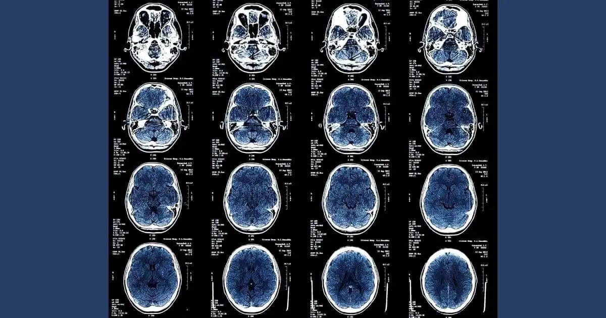 Quản lý Nội dung tại Viện Ung Thư Quốc Gia: Hiểu rõ Hướng Dẫn Mới