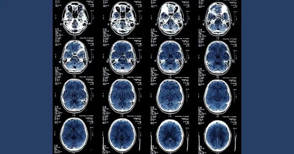 Thông tin về các chủ đề này cần được NCI phê duyệt trước khi công bố.
